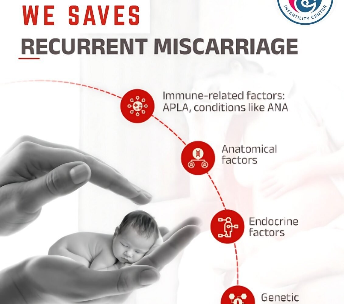 miscarriage